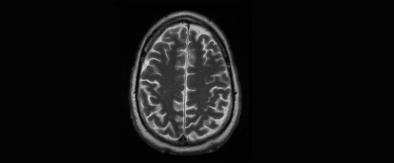 La mémoire sélective : quand notre cerveau fait le tri