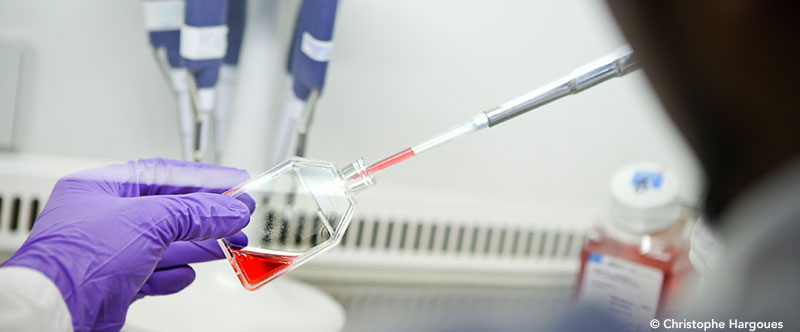 Un nouveau test sanguin pour diagnostiquer la maladie d’Alzheimer