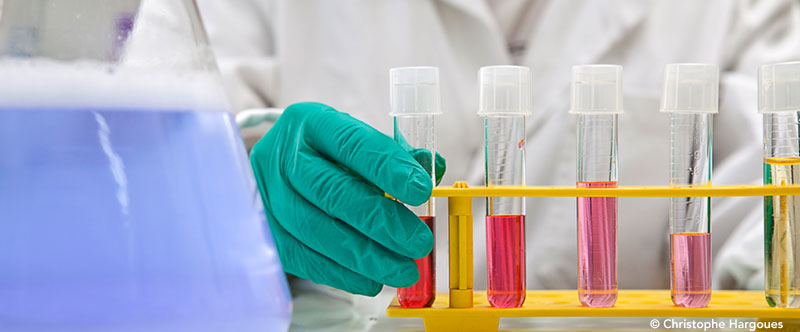 Une bactérie liée à une inflammation des gencives serait-elle un facteur de risque de la maladie d’Alzheimer ?