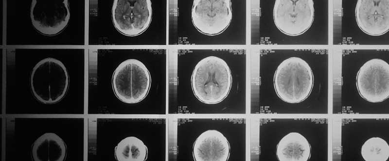 Cerveau, vieillissement et adaptation
