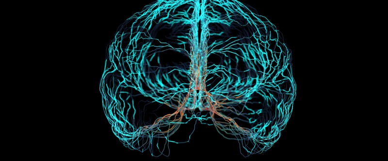 Le Donanemab