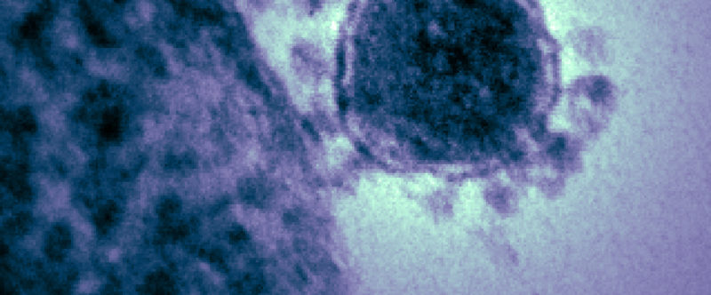 Coronavirus : quoi ? Qui ? Comment ?