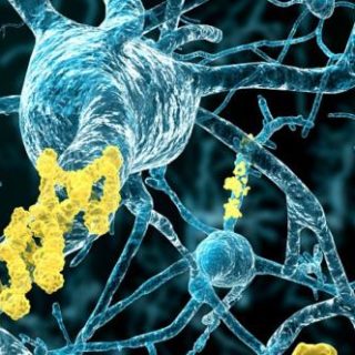 La maladie d’Alzheimer en chiffres